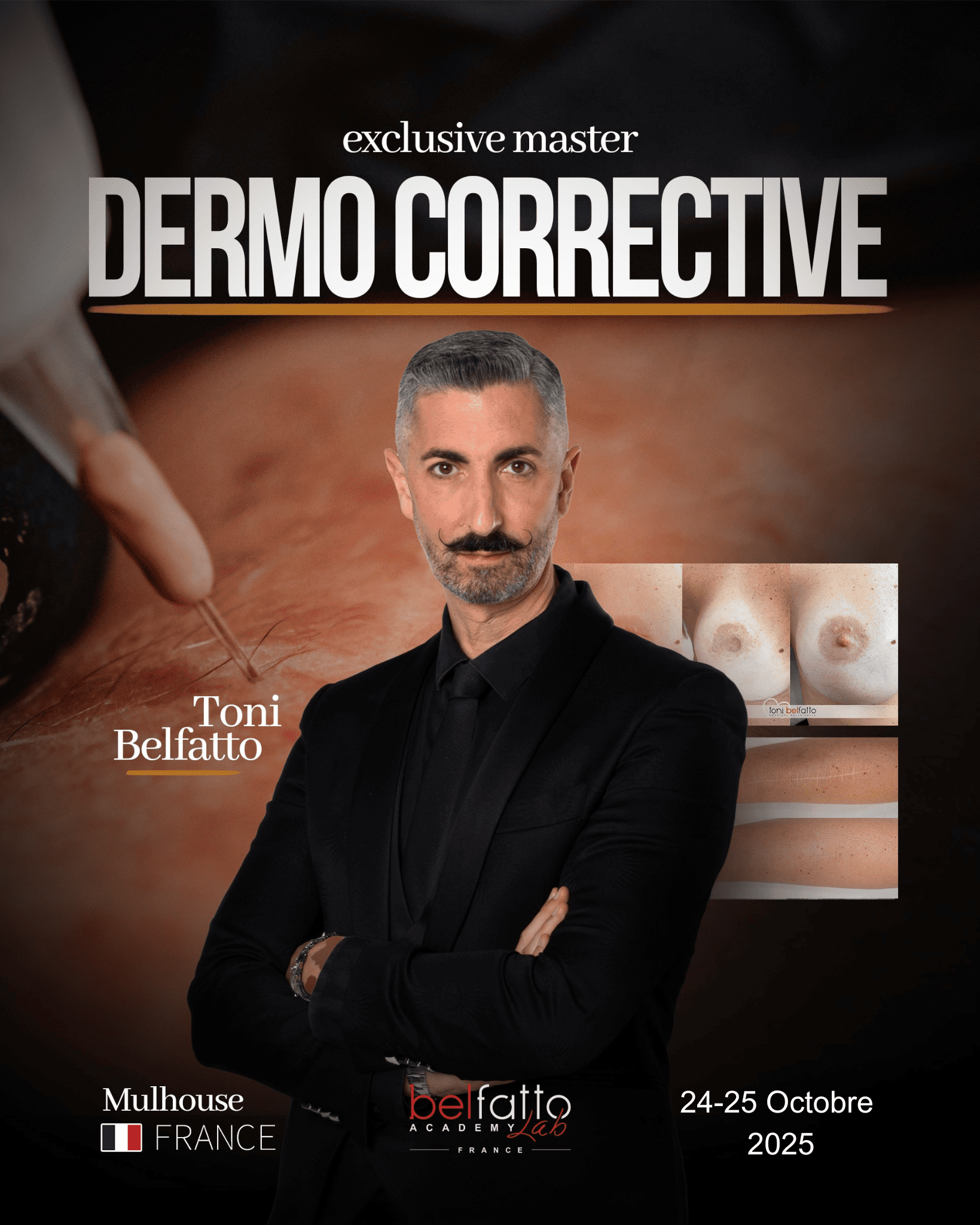 Formation Dermopigmentation Corrective Toni Belfatto